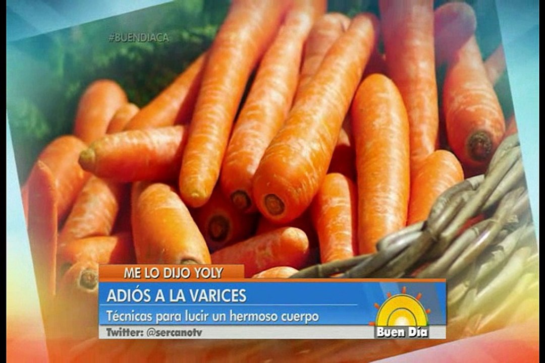 Remedios caseros para eliminar las varices