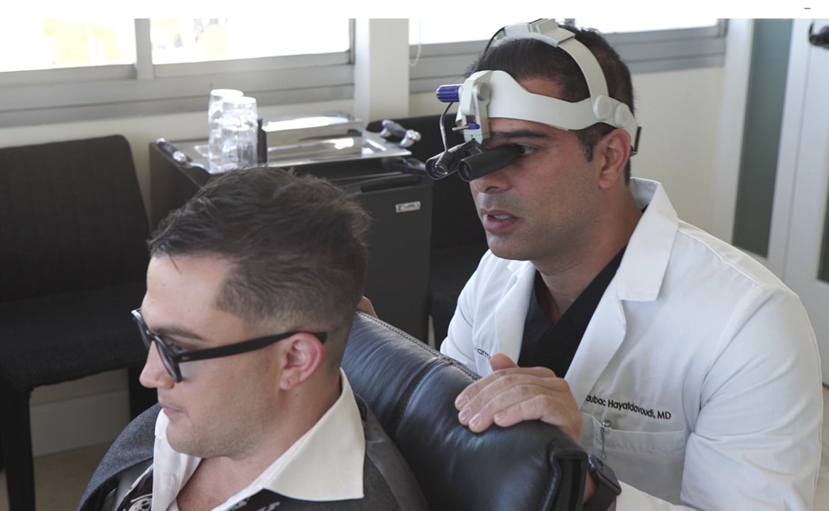 Hair transplant doctors in Los Angeles – Dr. Baubac