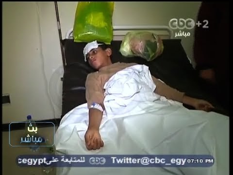 #بث_مباشر - وكيل وزارة #الصحة للطب الوقائي : ندرس عينات من مصادر مياه الشرب بالقرية لتحليلها
