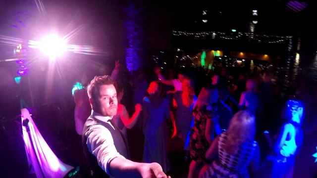 Celebrity Hair Transplants - Alvi Armani Clinic Los Angeles