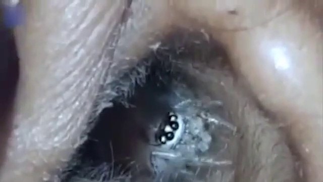 Vous allez comprendre pourquoi son oreille la grattait... Flippant