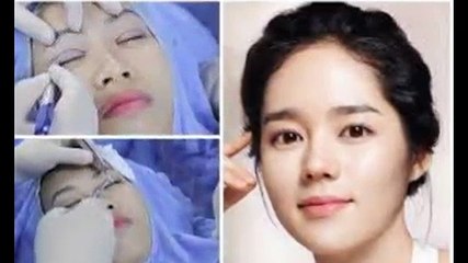 Nhấn mí Hàn Quốc mang lại đôi mắt đẹp trong sáng