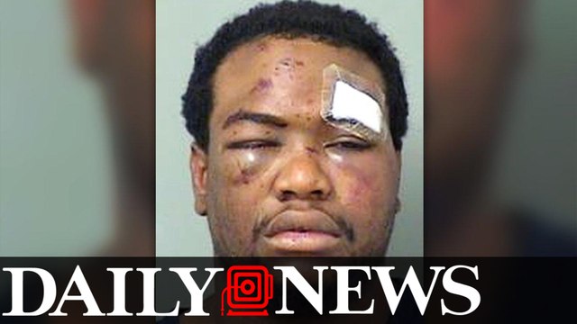 Florida Cops To Face Federal Charges For Covering Up 2014 Beating