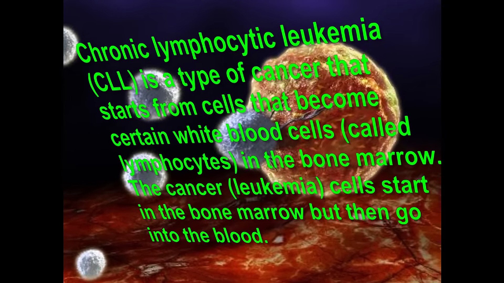 Chronic Lymphocytic Leukemia -- Signs and Symptoms of this Disease