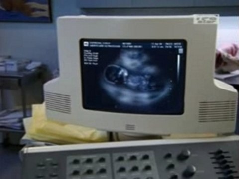 Scrubs saison 5 bébé village people