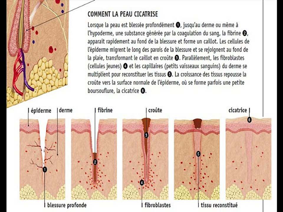 COMMENT LA PEAU CICATRISE