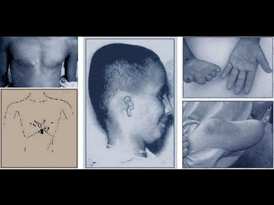 ¿Las marcas del nacimiento hablan de nuestra vida pasada? (Parte 2)