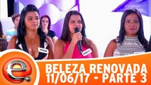 Beleza Renovada - 11.06.17 - Parte 3