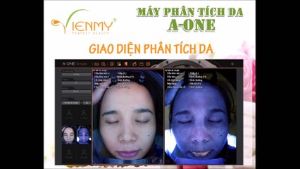 Máy phân tích da A-ONE - Công ty Viên Mỹ hướng dẫn sử dụng