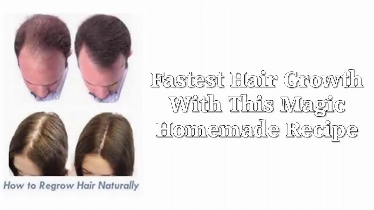 Fastest Hair Growth With This Magic Homemade Recipe 3 Ingredients Only