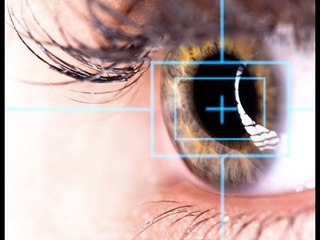 En quoi consiste une opération au laser en cas de myopie ?