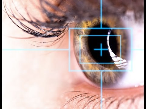 En quoi consiste une opération au laser en cas de myopie ?