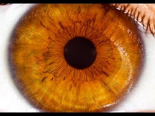 Comment peut survenir un décollement de la rétine ?