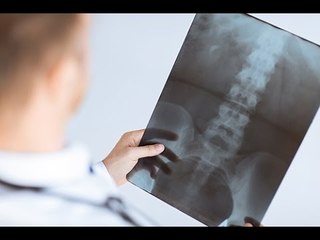 Bec de perroquet : quels examens médicaux doit-on passer ?