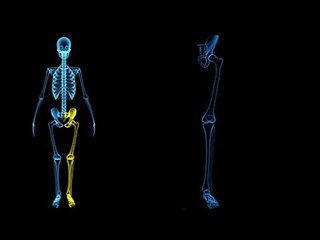 Quelles sont les autres localisations des varices?