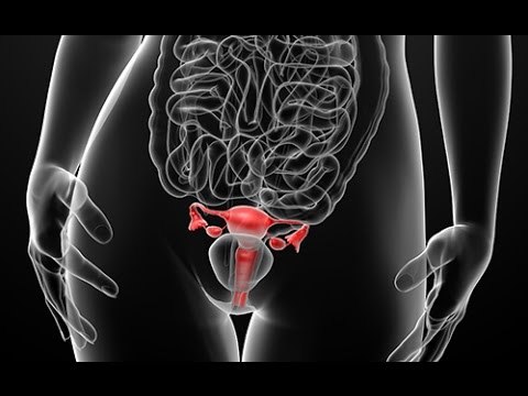 Distinguer les pertes blanches des leucorrhées anormales ?