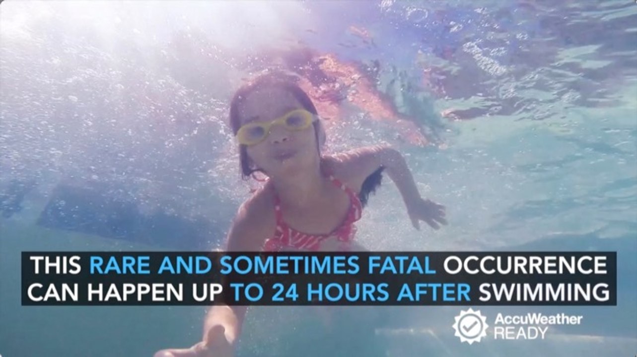 What is dry drowning?