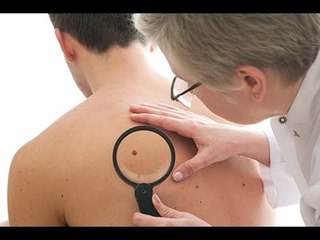 Cancer de la peau : quel pronostic ?