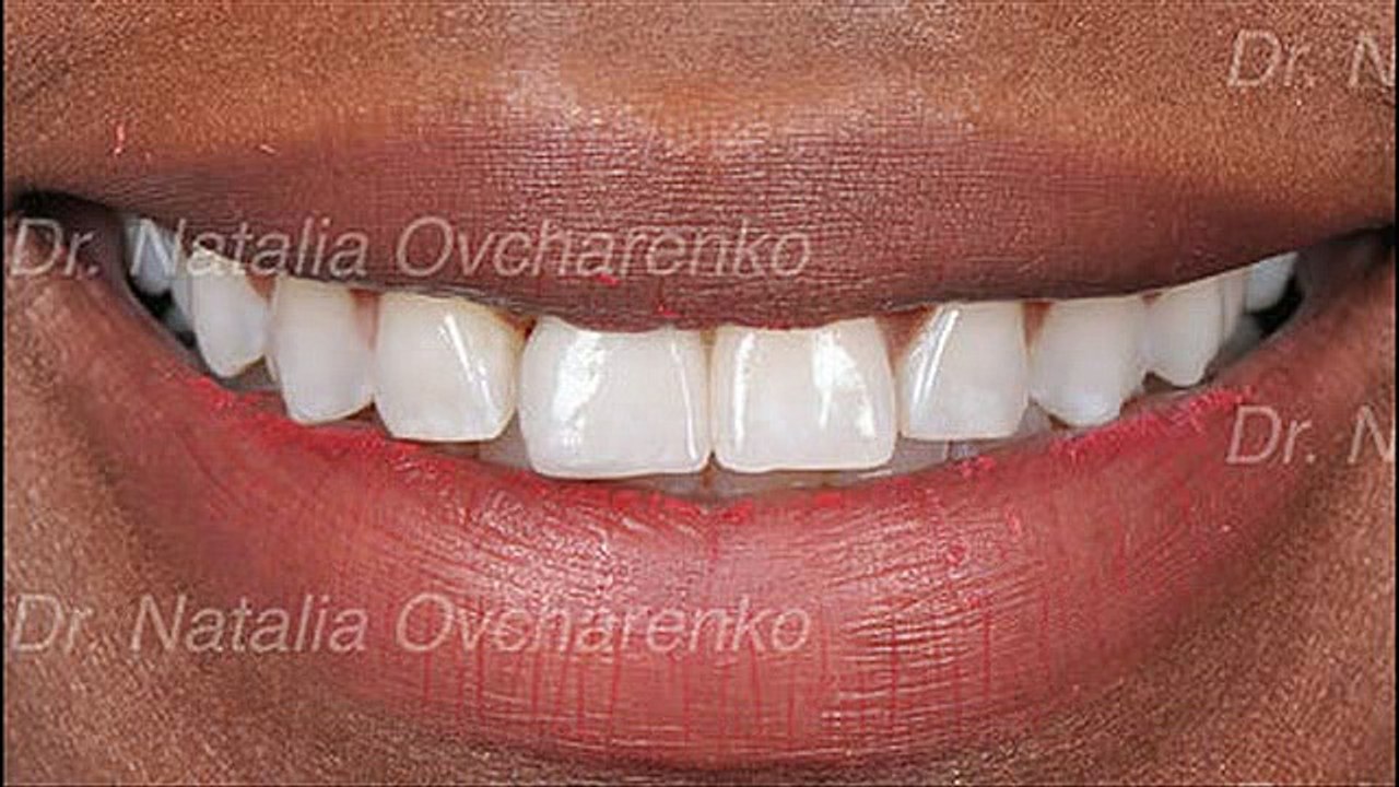 West Frisco Dental And Implants  - Dentist In Frisco TX - Frisco Dentist