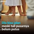 baru lahir bisa jalan