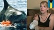 Shark attacks: North Carolina woman loses arm in horrific shark attack while snorkeling