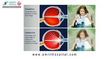 Cataract Surgery Procedure in Chennai - Cataract Examination - Cataract Surgery with Laser in India