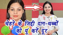 Apple cider vinegar for Pimple Marks | मुंहासे के दाग का कारगार उपचार | BoldSky