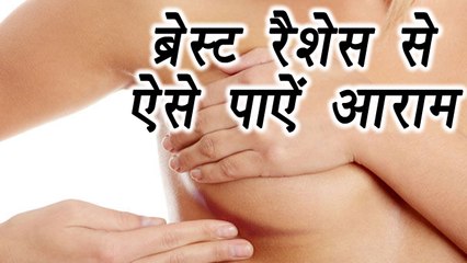 Breast Rashes, Home Remedies