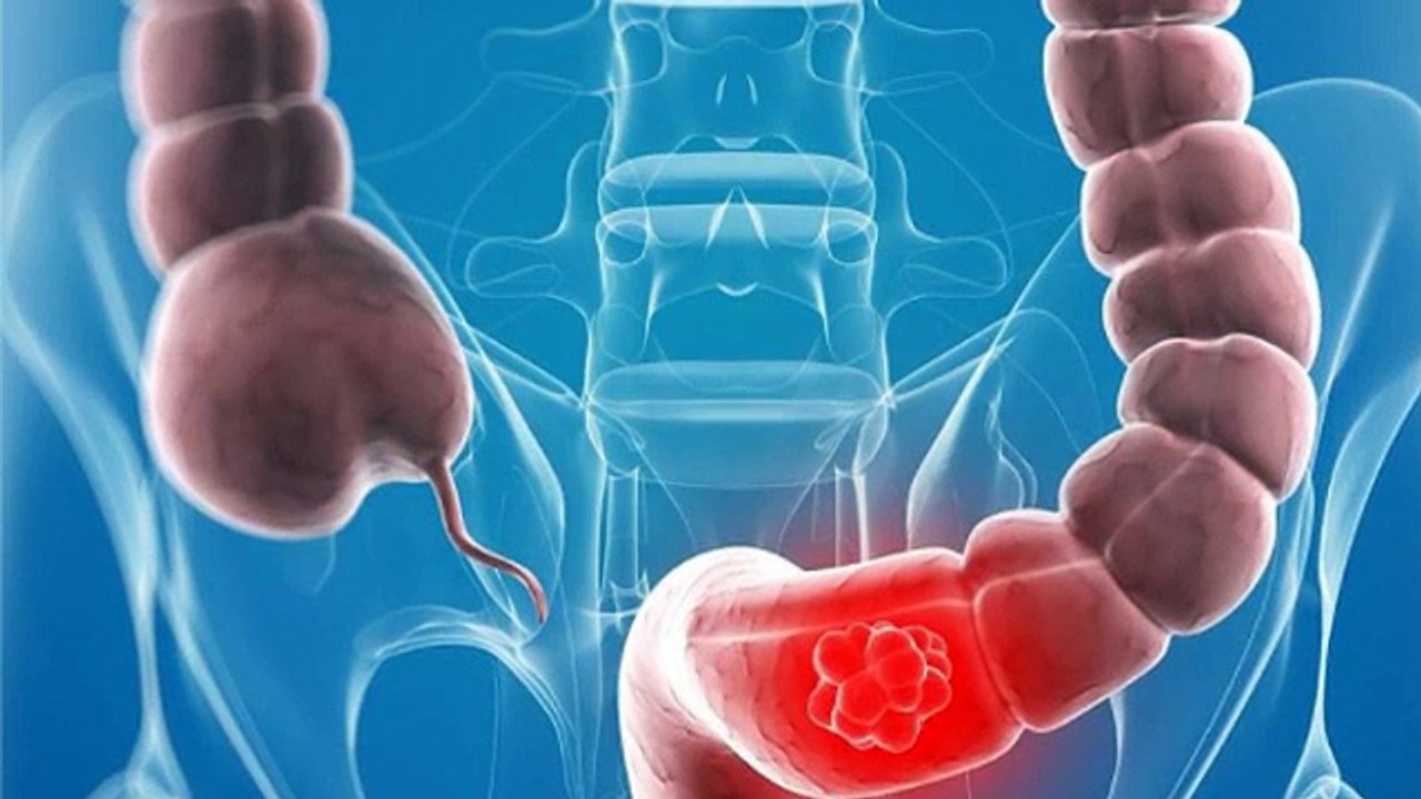 Gastroenterology testing by Accu Reference
