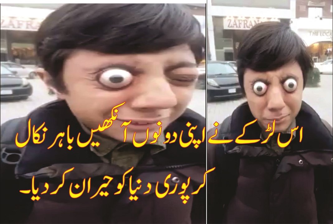 اس لڑکےنے اپنی دونوں آنکهیں باہر نکال کر سب کو حیران کردیا