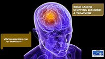 Brain Cancer-Symptoms,Diagnosis & Treatment