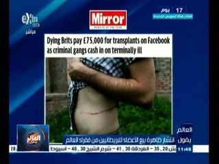 #العالم_يقول | انتشار ظاهرة بيع الاعضاء للبريطانيين من فقراء العالم