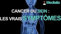 Cancer du sein : quels sont les vrais symptômes ?