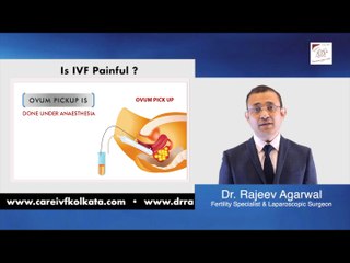 IS IVF PAINFULL - Dr. Rajeev Agarwal
