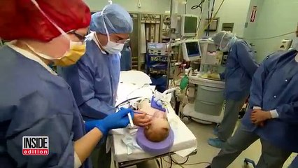 Ka lindur me një tumor gjigant, shikoni transformimin