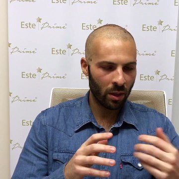 Fue hair transplant İstanbul- Saç ekimi İstanbul