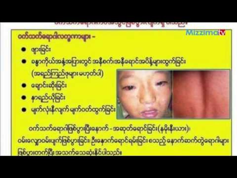 ဝက္သက္ေရာဂါအျဖစ္မ်ားေန၍ ရန္ကုန္ရိွ ၿမိဳ႕နယ္ငါးခုတြင္ ကာကြယ္ေဆးထိုးေပးေန