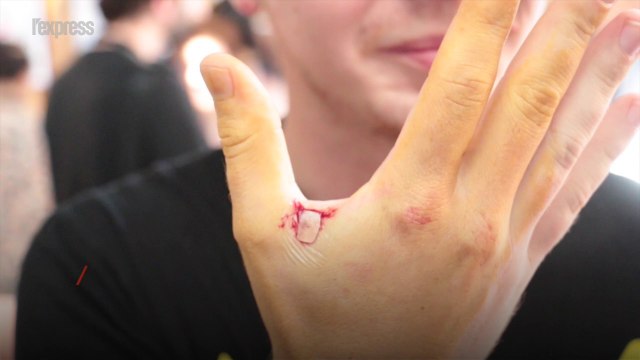 Humains augmentés: ils se font poser des puces dans la main