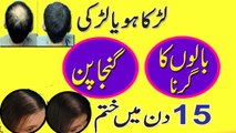 Hair Fall Treatment In Urdu || Balon Ka Girna Ganja Pan Khatam Karne Ka Nuskha Anam Home Remedy
