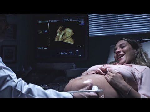 Impresión en 3D en ultrasonido permite que embarazada ciega conozco a su bebé