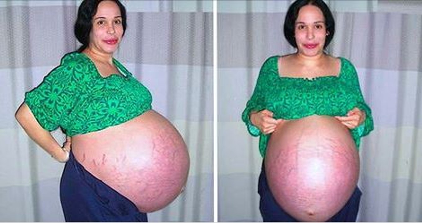 Single Mom For Having 8 Babies