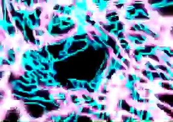 Kesedihanku DJ Remix Sammy Simorangkir Funkot