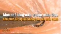 Màn nhổ lông mọc ngược chân thực đến mức 4tr người không tin vào mắt mình