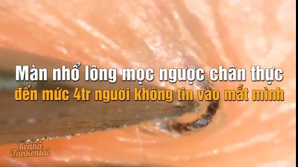 Màn nhổ lông mọc ngược chân thực đến mức 4tr người không tin vào mắt mình