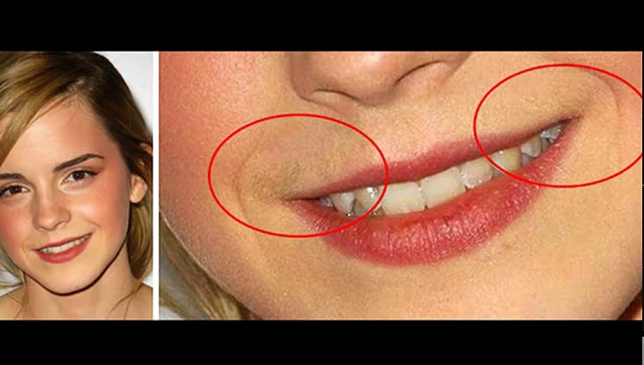 Face Hair Removal natural beauty Tips In Urdu