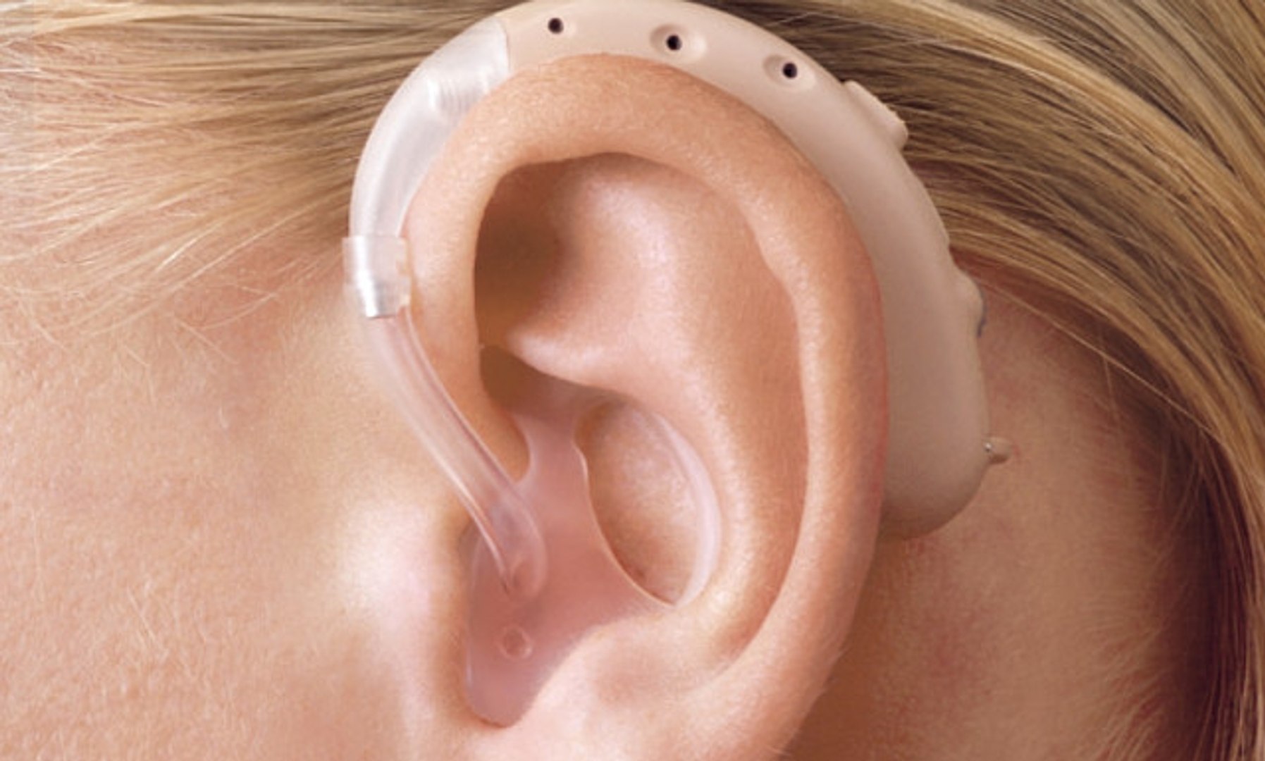 Где подобрать слуховой аппарат. Helix hearing слуховой аппарат. Современные слуховые аппараты. Слуховой аппарат детский. Слуховой аппарат накладной.