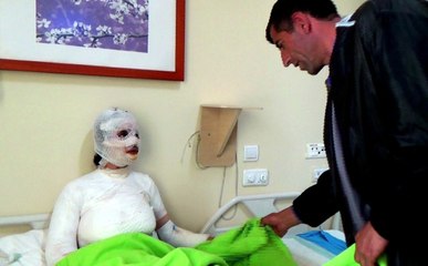 Temizlik Yaparken 1 Kova Kaynar Su Başından Aşağı Dökülen Kadının Vücudu Haşlandı