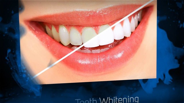 24 Hours Emergency Dental Care in Coral Springs - 954-997-5147