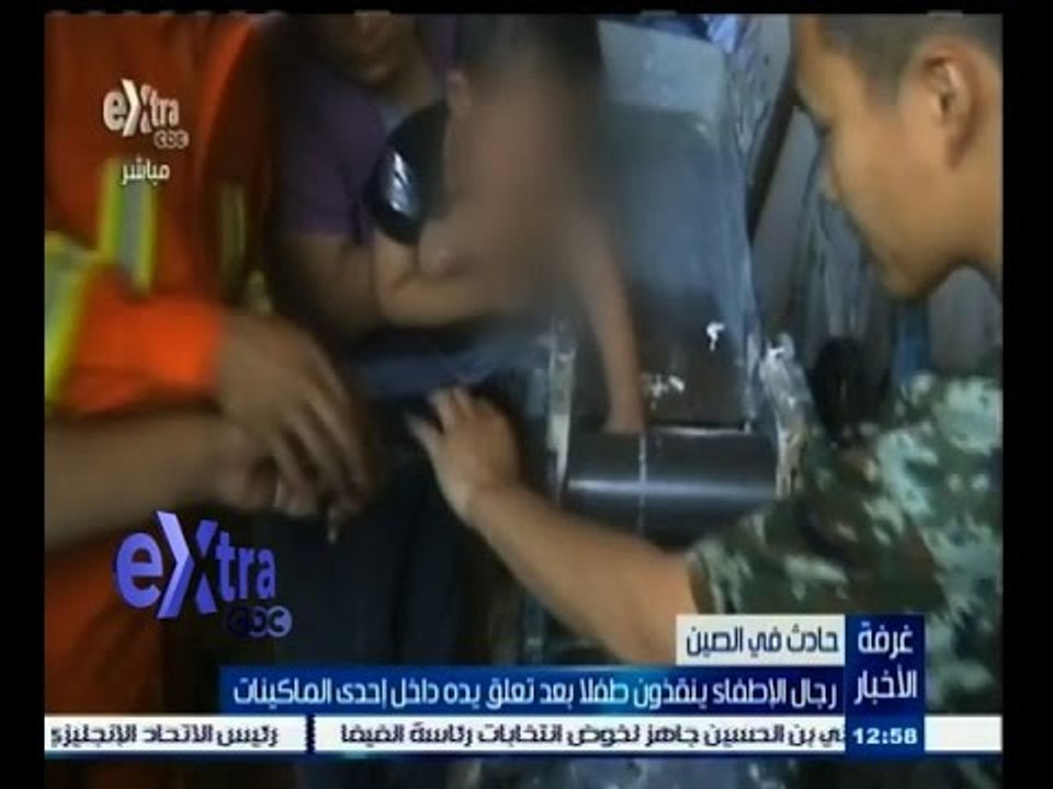 #غرفة_الأخبار | شاهد...بالفيديو رجال الاطفاء ينقذون طفلا بعد تعلق يده داخل إحدى الماكينات