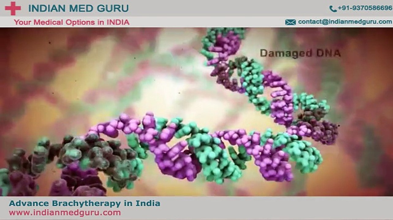 Advance Brachytherapy in Mumbai - advanced cancer treatment at affordable cost in Mumbai , India